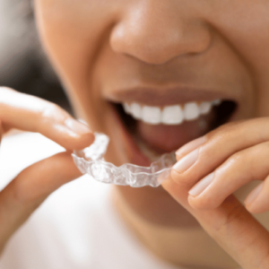 B2B custom night guard outsourcing and digital occlusal splint CAD design for US labs