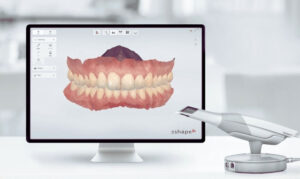 B2B lab outsourcing workflow using 3Shape Digital Impression Technology and TRIOS scanners