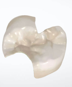 Digital Dental Inlay Onlay CAD Design Service in Exocad