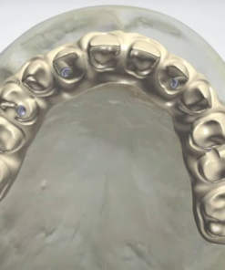 Digital All-on-X CAD Design Service for Hybrid Bars and Thimble structures in Exocad