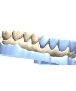 Digital Bleaching Tray Model CAD Design Service for 3D printing and thermoforming