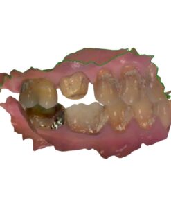 Digital CEREC to STL Conversion Service for Primescan and Exocad workflows