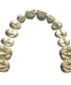 Dental Coping CAD Design Service for PFM and PFZ Frameworks