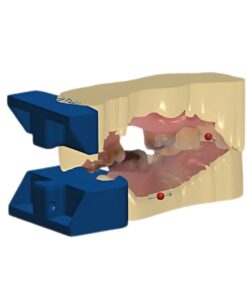 Digital Crown and Bridge Model CAD Design Service for 3D printing