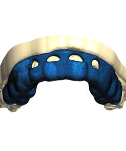 Digital Crown Lengthening Guide CAD Design Service for gingivectomy and ostectomy