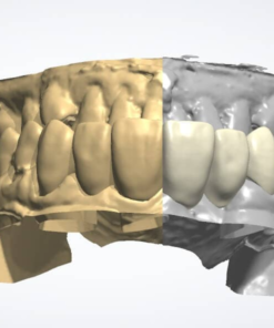 Overnight Dental Crown CAD Design Service in Exocad 3Shape