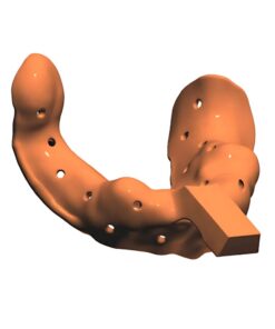 Digital Custom Tray CAD Design Service for 3D printable implant and denture trays