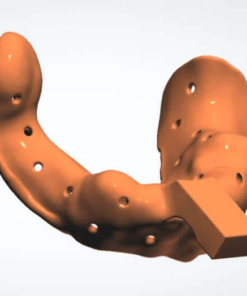 Digital Custom Impression Tray CAD Design Service ready for 3D printing