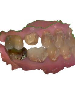 Medical-grade DICOM to STL conversion service for 3D printing surgical guides