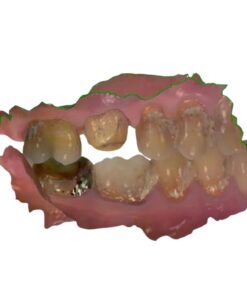 Medical-grade DCM to STL conversion service for 3D printing and CAD planning