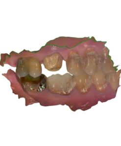 Digital STL to DCM Conversion Service for 3Shape Dental System workflows