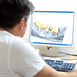 Elite Dental CAD Design Technician working on Exocad and 3Shape for US B2B dental labs