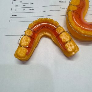 Premium B2B Hawley retainer manufacturing and orthodontic lab outsourcing for US clinics